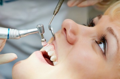 歯の検査を受けている女性