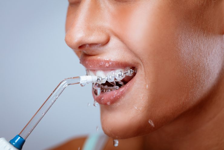 女性がウォーターピックで歯を洗っている