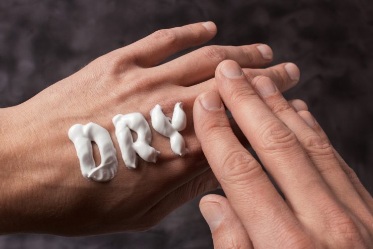 手の甲にクリームでDRYの字を書いている